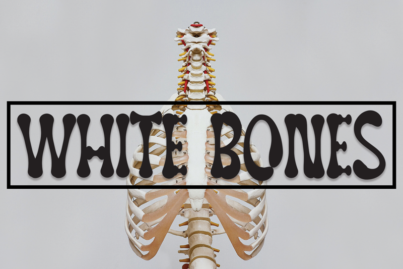 White Bones